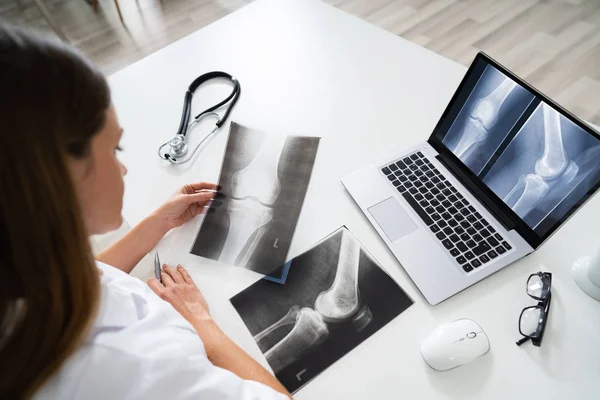 Arzt Betrachtet Fuß Röntgen Auf Laptop Mit Stethoskop — Stockfoto