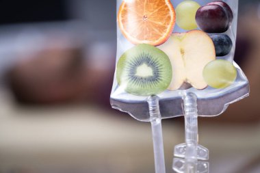 Hastanedeki adam Saline Bag 'in İçinde Meyve Dilimleri İnfüzyonu yaptırıyor. 