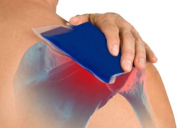 Close-up Of Hand Holding Ice Gel Pack On Shoulder Over White Background