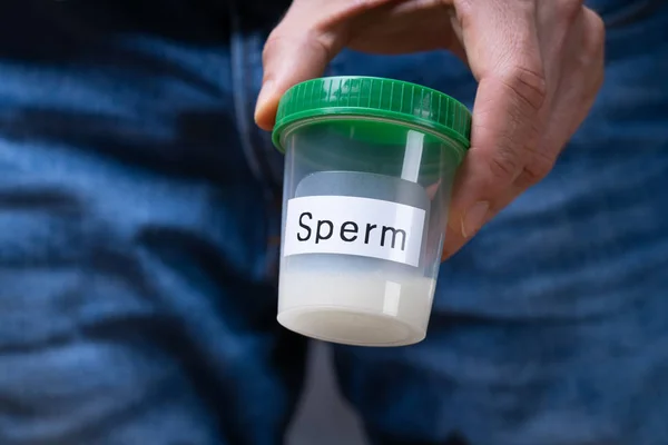 Sperma Donor Holding Container Het Maken Van Duimen — Stockfoto