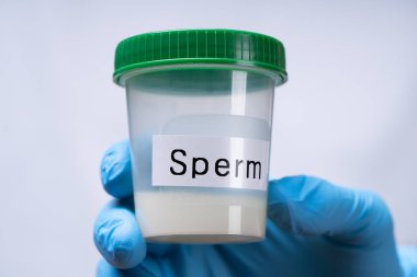Doktor El Lastik Eldiven Tutucu Sperm Donör Konteynırı