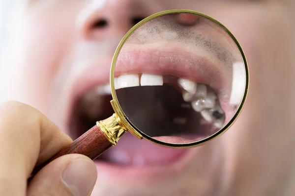 Paciente Masculino Com Dentes Faltantes Examinados Pelo Dentista — Fotografia de Stock