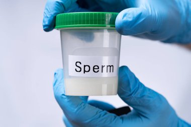 Doktor El Lastik Eldiven Tutucu Sperm Donör Konteynırı