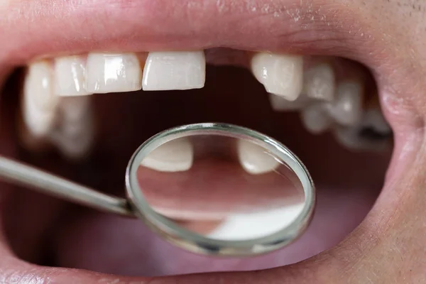 Paciente Masculino Com Dentes Faltantes Examinados Pelo Dentista — Fotografia de Stock
