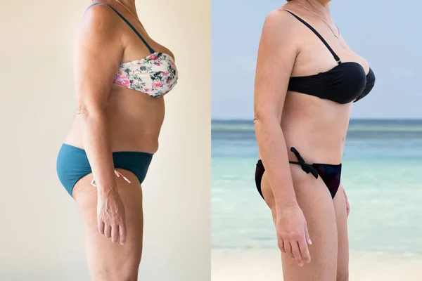 Mature Woman Fat Slim Concept Standing — Stock Photo, Image