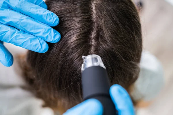 Крупный План Дерматолога Использующего Трихоскоп Лечения Падения Волос — стоковое фото