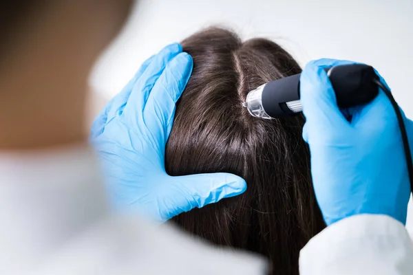 毛髪秋治療にトリコスコープを用いた皮膚科医のクローズアップ — ストック写真