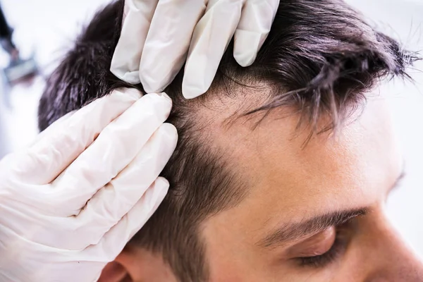 Gros Plan Main Dermatologue Qui Vérifie Les Cheveux Patient — Photo