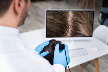 Saç Düşme Tedavisi Için Trichoscope Kullanarak Dermatolog Close-up Kliniği