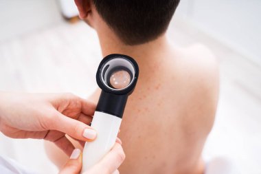 Yakın çekim kişi el Dermatoscope adamla cilt akne incelenmesi