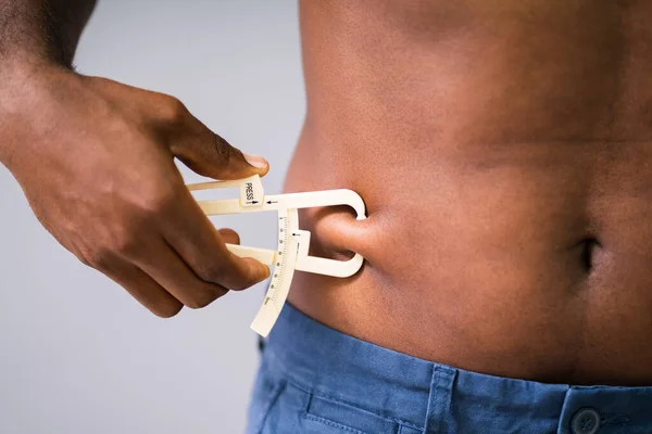 Close-up Of Man Measuring Stomach Fat With Caliper