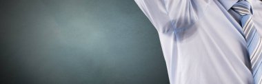 Terleme ve hiperhidrozdan dolayı koltuk altı ter lekesi. Deodorant lekeleri
