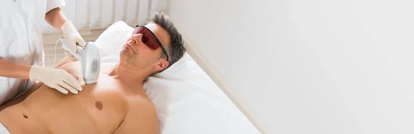 Laser Hair Removal For Man And Skin IPL Treatment