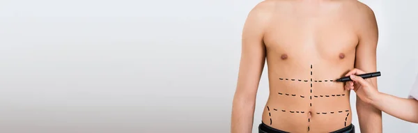 Aesthetic Plastic Surgery Male Liposuction Body Abdomen — Stock Photo, Image