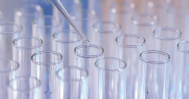 Laboratuarda test tüpleri yakın çekim