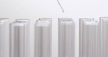 Pipet bırakarak örnek test tüpleri içine 