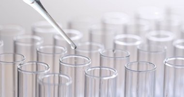 Sıvı test tüpleri bırakarak pipet 