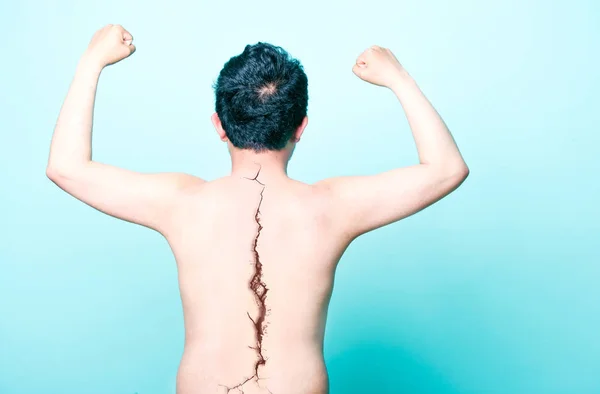 Man with a crack on spine — Stock Photo, Image