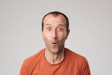 Şaşırdım genç adam.