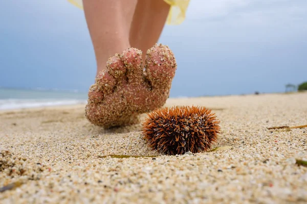Ein Mann läuft am Strand entlang und ist dabei, auf einen giftigen Seeigel zu treten. — Stockfoto