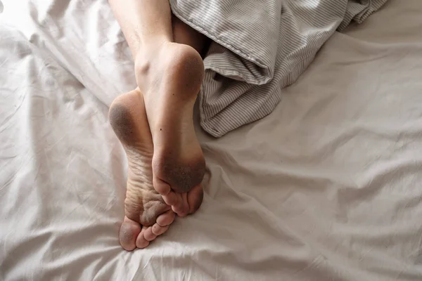 Battaniyenin Üzerinde Uyuyan Birinin Kirli Çıplak Ayakları Hijyen Sağlıksız Koşullar — Stok fotoğraf
