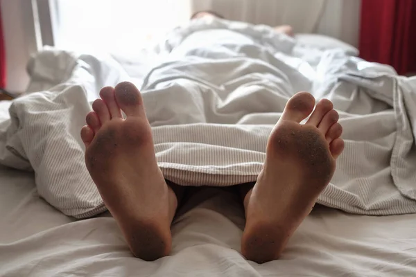 Sucios Pies Desnudos Una Persona Durmiendo Que Aparece Manta Una — Foto de Stock