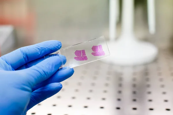 Histolojik karaciğer doku örneği ile mavi eldiven el