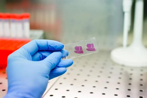 Histolojik karaciğer doku örneği ile mavi eldiven el