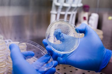 CAR terapisi için bakteri yetiştirmek lösemi, lenfoma terapisi için yeni bir yöntem ve aynı zamanda çovid-19 tratment için de test edilebilir.