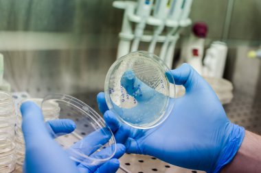 CAR terapisi için bakteri yetiştirmek lösemi, lenfoma terapisi için yeni bir yöntem ve aynı zamanda çovid-19 tratment için de test edilebilir.