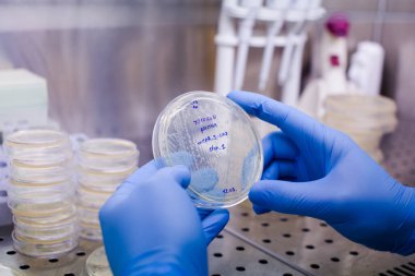 CAR terapisi için bakteri yetiştirmek lösemi, lenfoma terapisi için yeni bir yöntem ve aynı zamanda çovid-19 tratment için de test edilebilir.