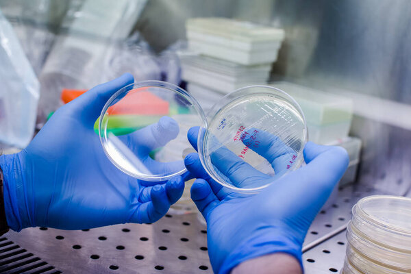 Growing bacteria to create CAR therapy - the novel method for leukemia, lymphoma therapy, and also could be tested for severe covid-19 tratment