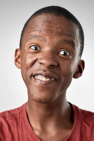 Homem africano fazendo expressão boba — Fotografia de Stock