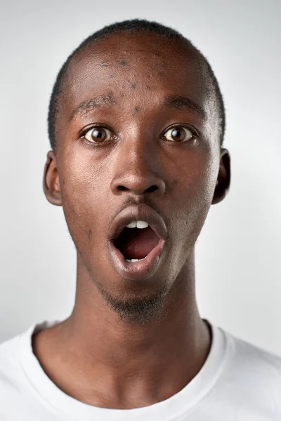 Hombre africano haciendo expresión tonta — Foto de Stock