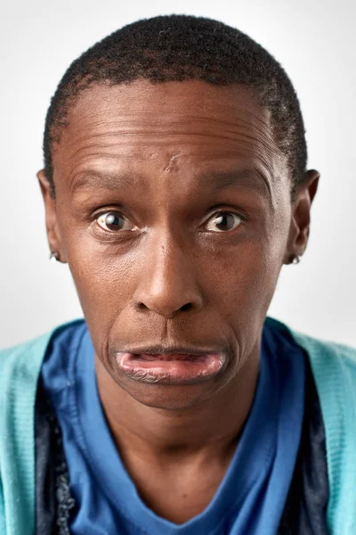 माणूस मूर्ख अभिव्यक्ती चेहरा बनवणे — स्टॉक फोटो, इमेज