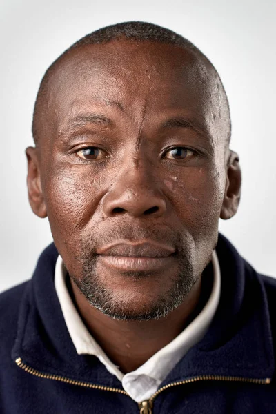 Hombre africano adulto sin expresión — Foto de Stock