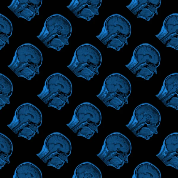 Безшовний візерунок сканування МРТ шістдесятирічної кавказької жіночої голови в сагітальній або поздовжній площині - класичний синій колір на чорному тлі — стокове фото