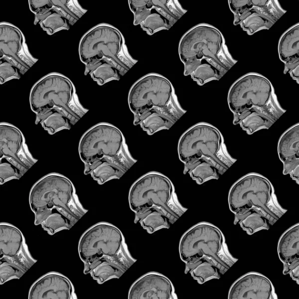 Безшовний візерунок сагітального МРТ сканування шістдесятирічної кавказької жіночої голови на чорному тлі — стокове фото