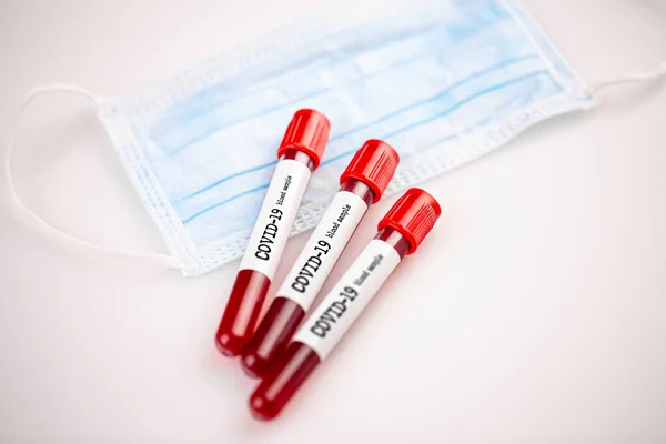 Muestra de sangre para coronavirus —  Fotos de Stock