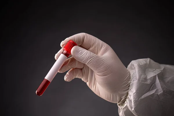 Científicos mano con tubo de análisis de sangre — Foto de Stock