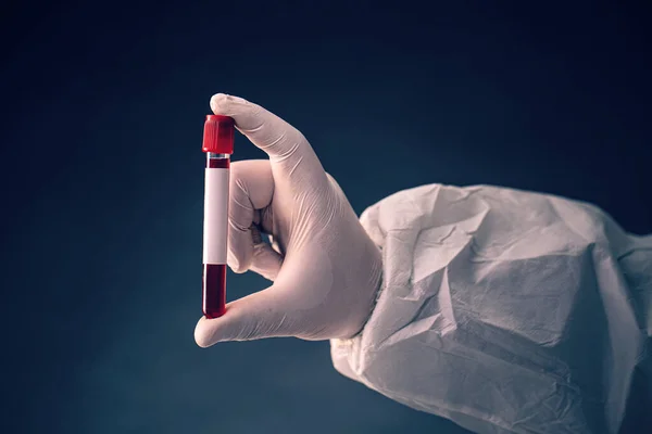 혈액 샘플 테스트 튜브 — 스톡 사진