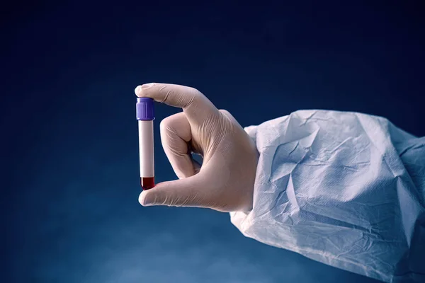 Técnico de laboratorio con un tubo de sangre — Foto de Stock