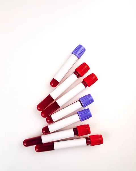 Tubo sanguíneo con muestra de sangre —  Fotos de Stock