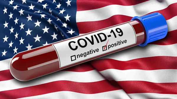Flag of the United States of America with a positive blood test for the Corona virus - Covid-19. 3D illustration concept for blood testing for diagnosis of the new Corona virus.