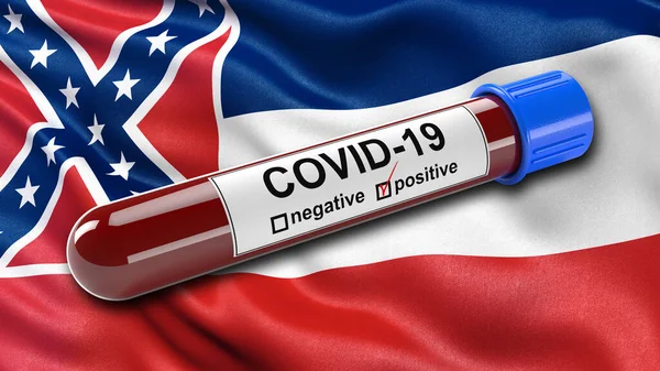 US state flag of Mississippi waving in the wind with a positive Covid-19 blood test tube. 3D illustration concept for blood testing for diagnosis of the new Corona virus.