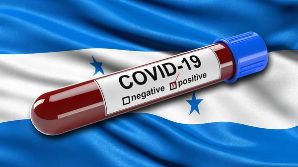 ホンジュラスの旗は 肯定的なCovid 19血液検査管で風に振っています 新しいコロナウイルスの診断のための血液検査のための3Dイラストコンセプト — ストック写真
