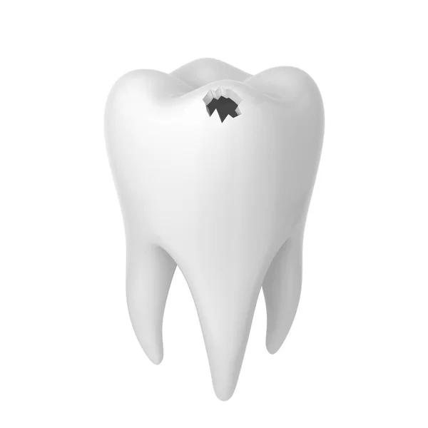 Buraco num dente. ilustração 3d isolado no fundo branco — Fotografia de Stock