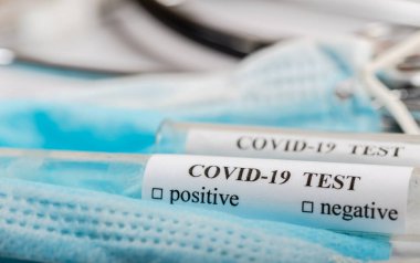 Coronavirus COVID-2019 kan test tüpleri, test formu ve diğer tıbbi objelerle test konsepti