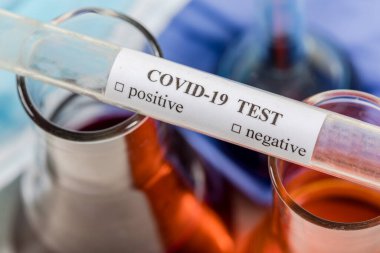 Coronavirus COVID-2019 kan test tüpleri, test formu ve diğer tıbbi objelerle test konsepti