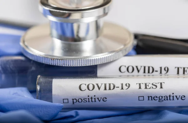 Coronavirus Covid 2019 Test Concept Blood Test Tubes Μορφή Δοκιμασίας — Φωτογραφία Αρχείου